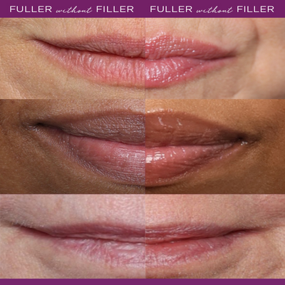 Peptide Lip Booster