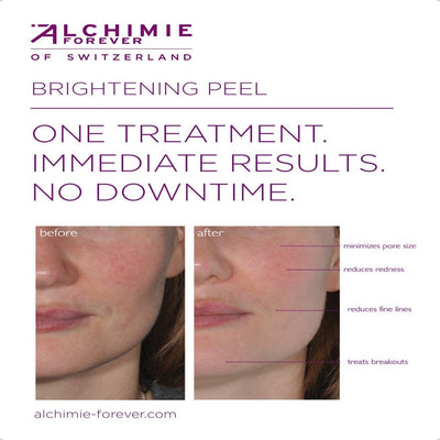 Wholesale - Brightening peel display easel